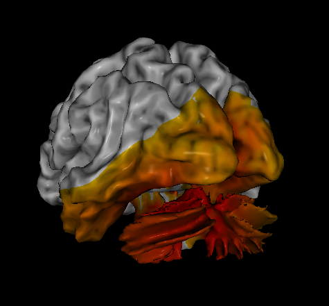 brain injuries causing concussions