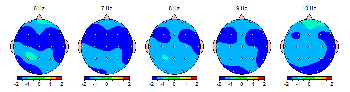 blue areas of brain represent depression from QEEG