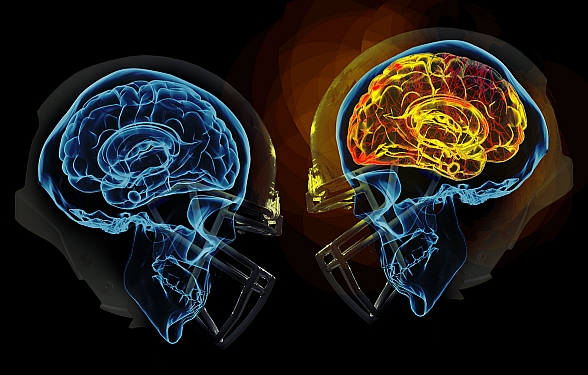 football head injuries