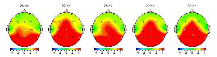 QEEG showing signs of stress
