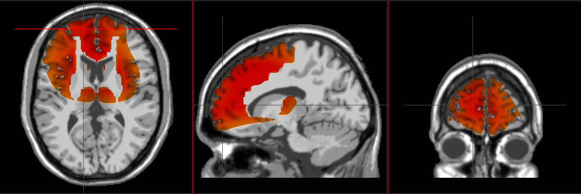 sw loretta neurofeedback graphic